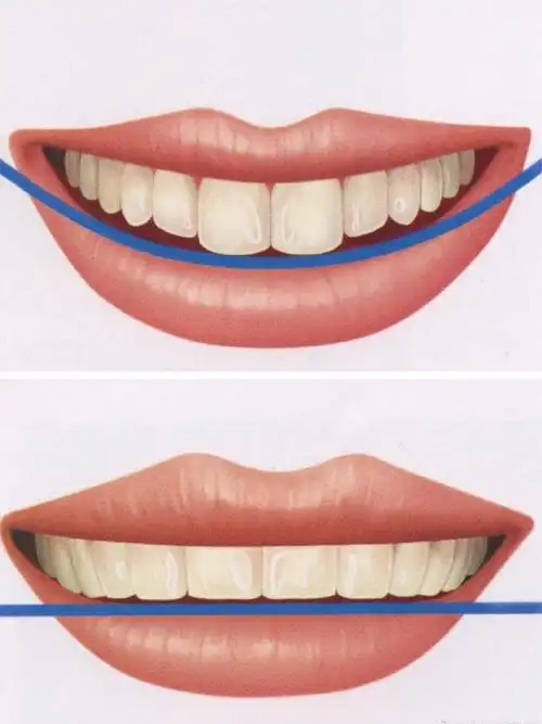 都说爱笑的孩子运气不会太差然而笑得好看却不是那