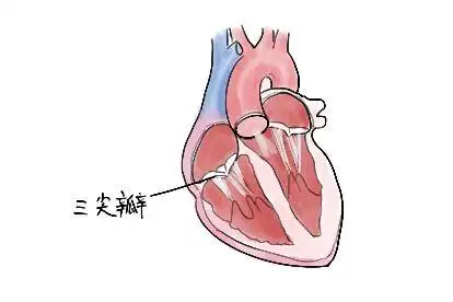 心脏三尖瓣图片