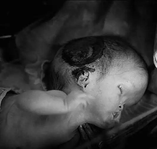 我怀孕两胎都是畸形儿回家打开木箱子看到一张照片我吓傻了