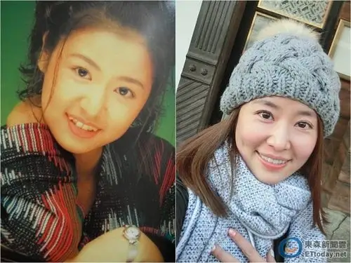 林心如戴牙套前有虎牙,拆牙套才变成现在的模样.