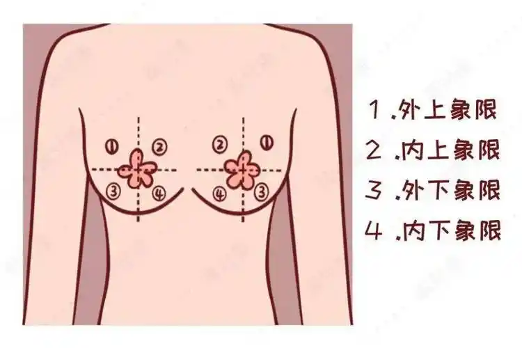 而且,乳腺癌肿块的位置好发于乳房的外上象限(以乳头为中心画十字将