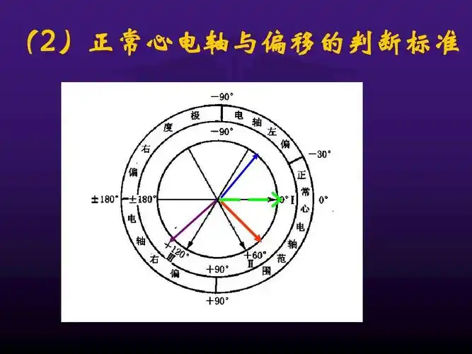 (2)正常心电轴与偏移的判断标准