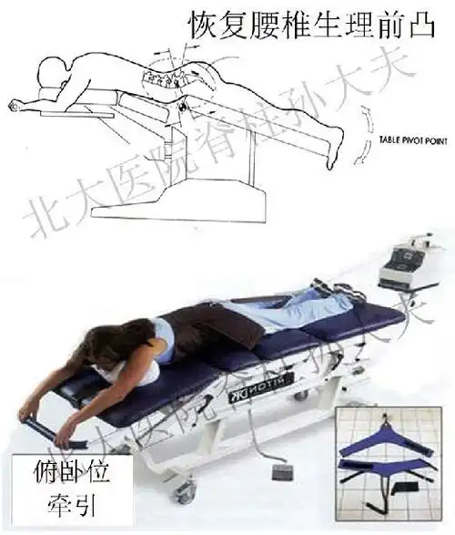腰椎间盘突出症患者的自我救赎----牵引篇