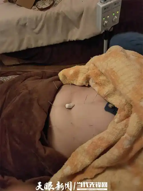 减肥行不行真有躺着就能瘦的办法吗针灸减肥了解一下