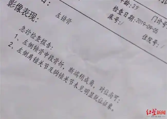 ↑小孩骨折诊断报告