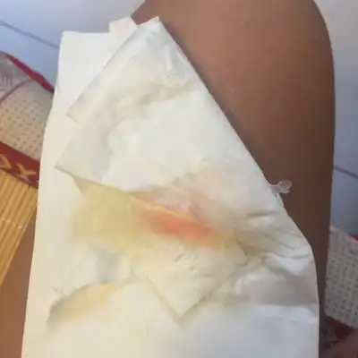 怀孕40天不到,上厕所卫生纸上有粉色的血丝,是怎麼回事!