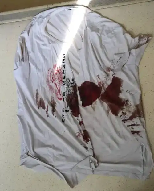 沾满鲜血的上衣