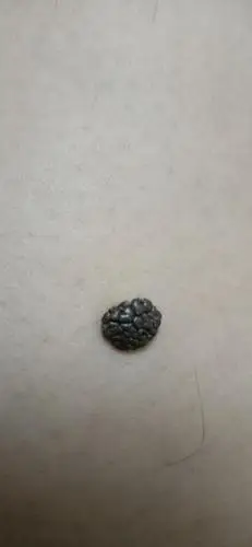 大于10㎜呈菜花状的痣是黑色素瘤吗?