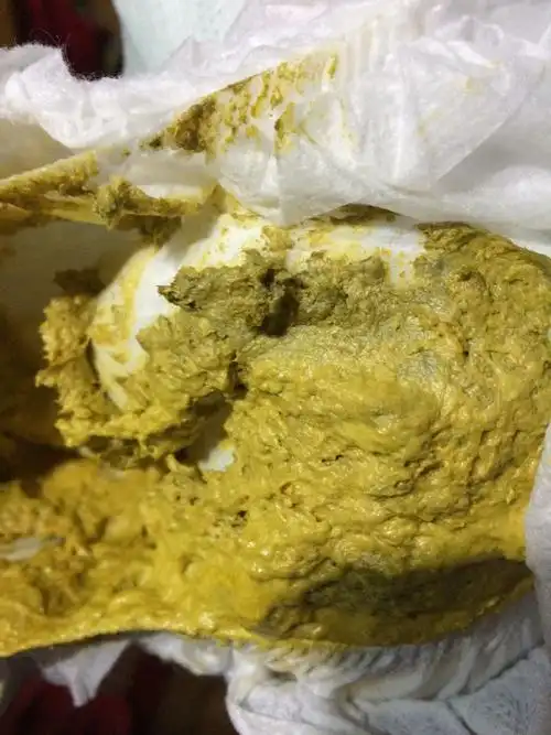 首先要告诉你出现青色大便绿便的原因是 奶粉中的铁元素身体没有吸收