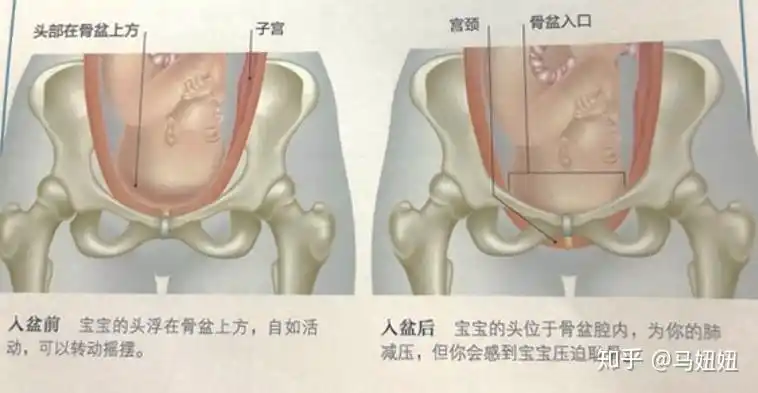 见红?宫缩?入盆?——我什么时候该去医院待产?