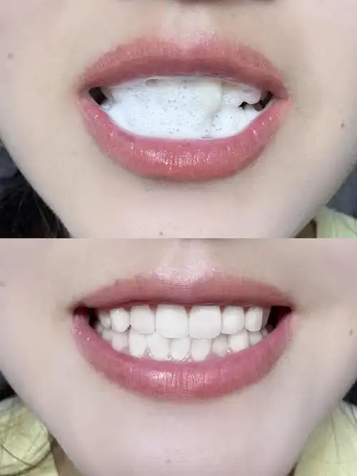 牙白真的是加分项!