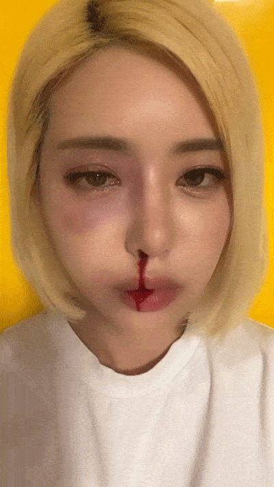 dj soda首先是被韩国恶人"霸凌",之后一张 soda 被揍到鼻青脸肿流鼻血