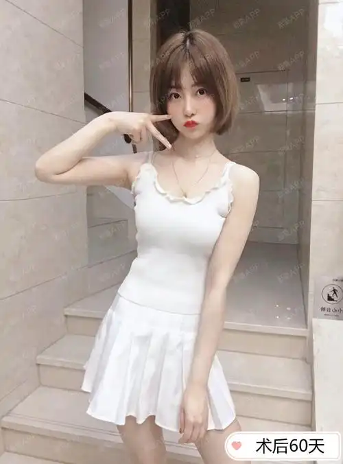 手臂吸脂—轻松拥有天鹅臂!