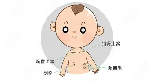 三凹征同样也要注意宝宝的状态, 哭闹或者活动也会