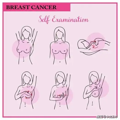乳腺癌成女性健康头号「杀手」,5 招远离它_手机搜狐网