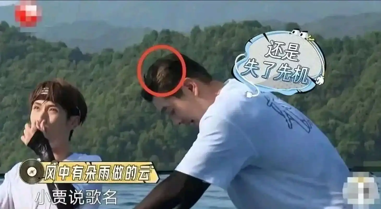 近日,黄晓明在《极限挑战9》中的秃顶和用假发片伪装的尴尬被曝光.