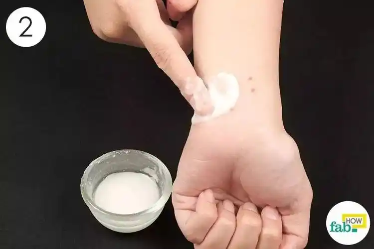 蚊子咬了别擦药涂点这个马上止痒还不花一分钱