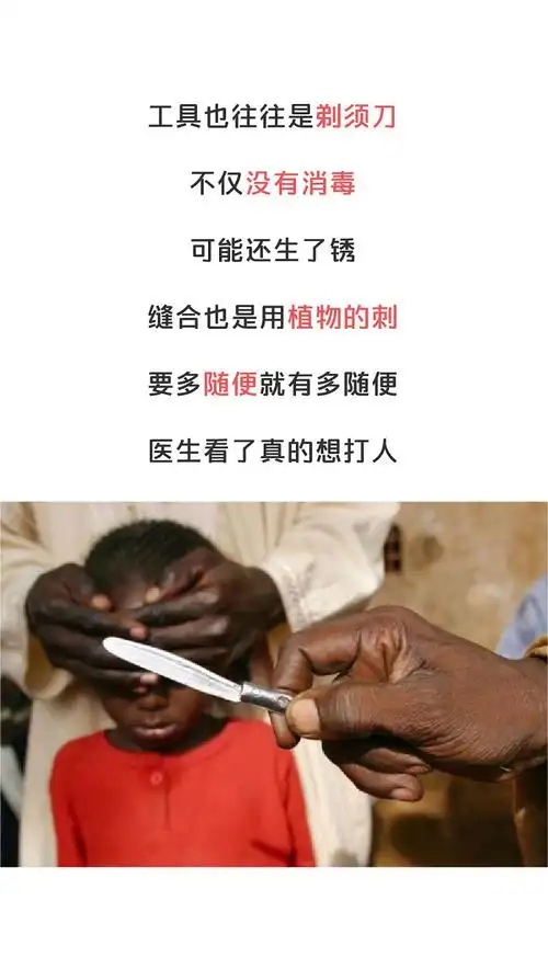 洗礼割礼是传统文化还是历史陋习