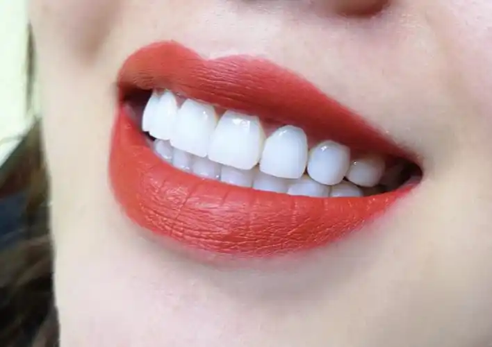 冰磁美牙培训黑龙江