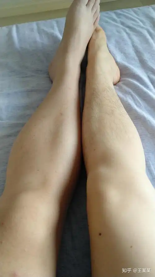 恼人的腿毛猕猴桃女孩