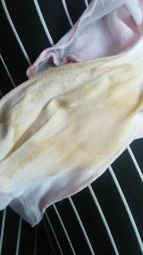 每天都这样.怎么回事呀