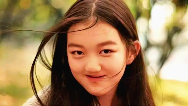 王菲女儿治疗唇裂花了几百万,嘴是治好了,但脸却越来越奇怪了?