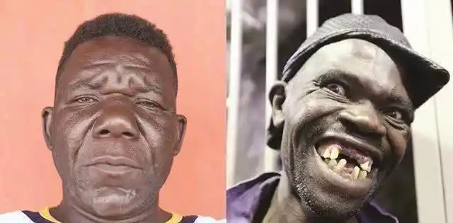 世界上最丑的男人四次选丑大赛冠军被抗议不准再参赛