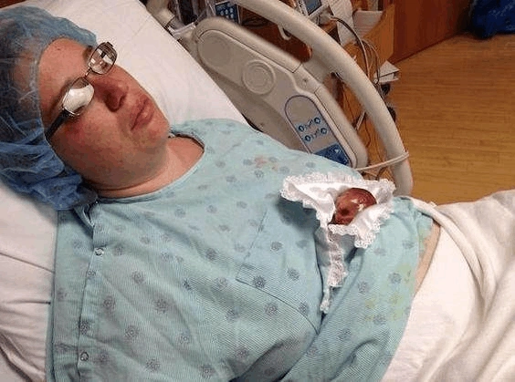 揭秘!火棉胶样婴儿能痊愈吗"衣香鬓影"-第2张图片-木瓜博客