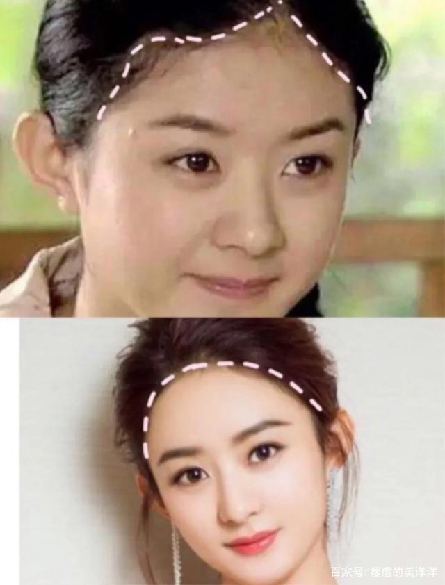 为什么说赵丽颖的发际线是教科书级别?
