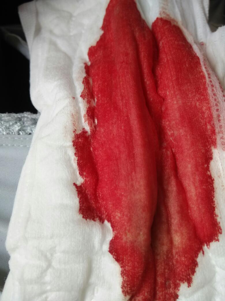 月经推迟了一个星期,今天来了,最近这几个月血鲜红鲜红的,觉得不正常.