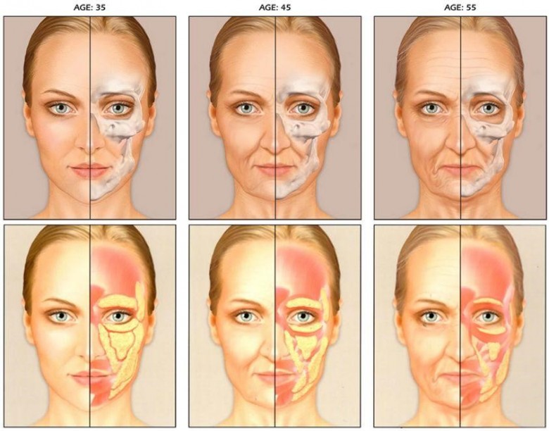 匠欣国际医美技术院长郑喜春浅谈面部年轻化及抗衰老