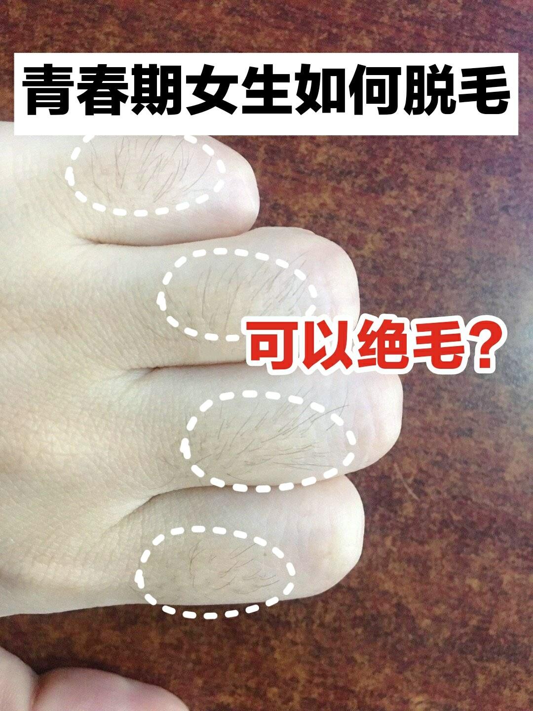 94 可能像我这样手上长汗毛的女生不多吧?