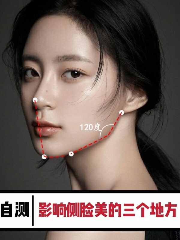 78下颌线_圈子-新氧美容整形