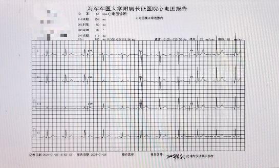 心脏很精贵,但检查要"只选对的不选贵的"|心电图_新浪财经_新浪网