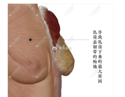 要说哪个效果好,其实,导致乳房下垂的原因多数都是乳房悬韧带的松弛