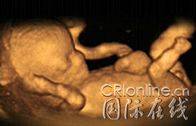 4维超声波成像技术揭示胎儿的动作和表情(图)
