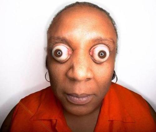 但现代医学表明,眼球外凸大多由甲亢,病理性近视,高眼压,眼球震颤等