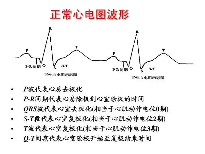 卫生 基础医学 实验家兔心电图及高钾血症的治疗ppt 正常心电图波形