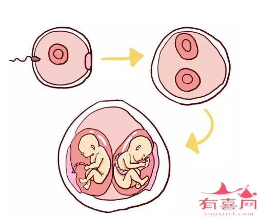 同卵双胞胎-同卵双胞胎形成原因-有喜网