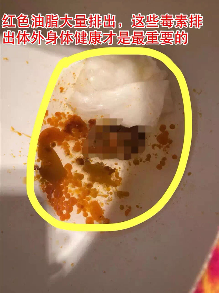 追答: 减肥就是要减脂肪,减水分没用的呢 追问: 你用什么产品 追答