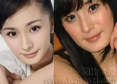 杨幂整容前后照片