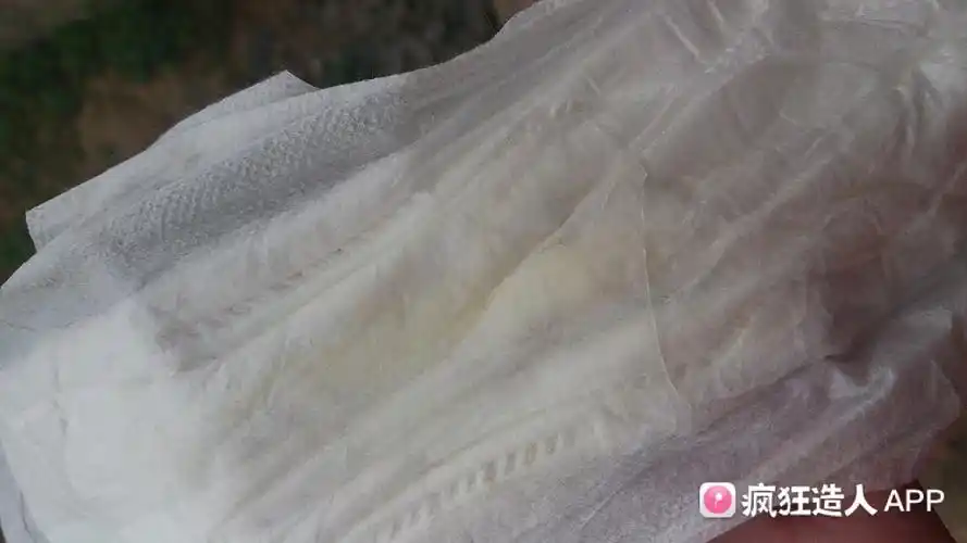 如题,7号排卵,今天我的白带拉丝了,我好高兴,大家看看是不是白带拉丝