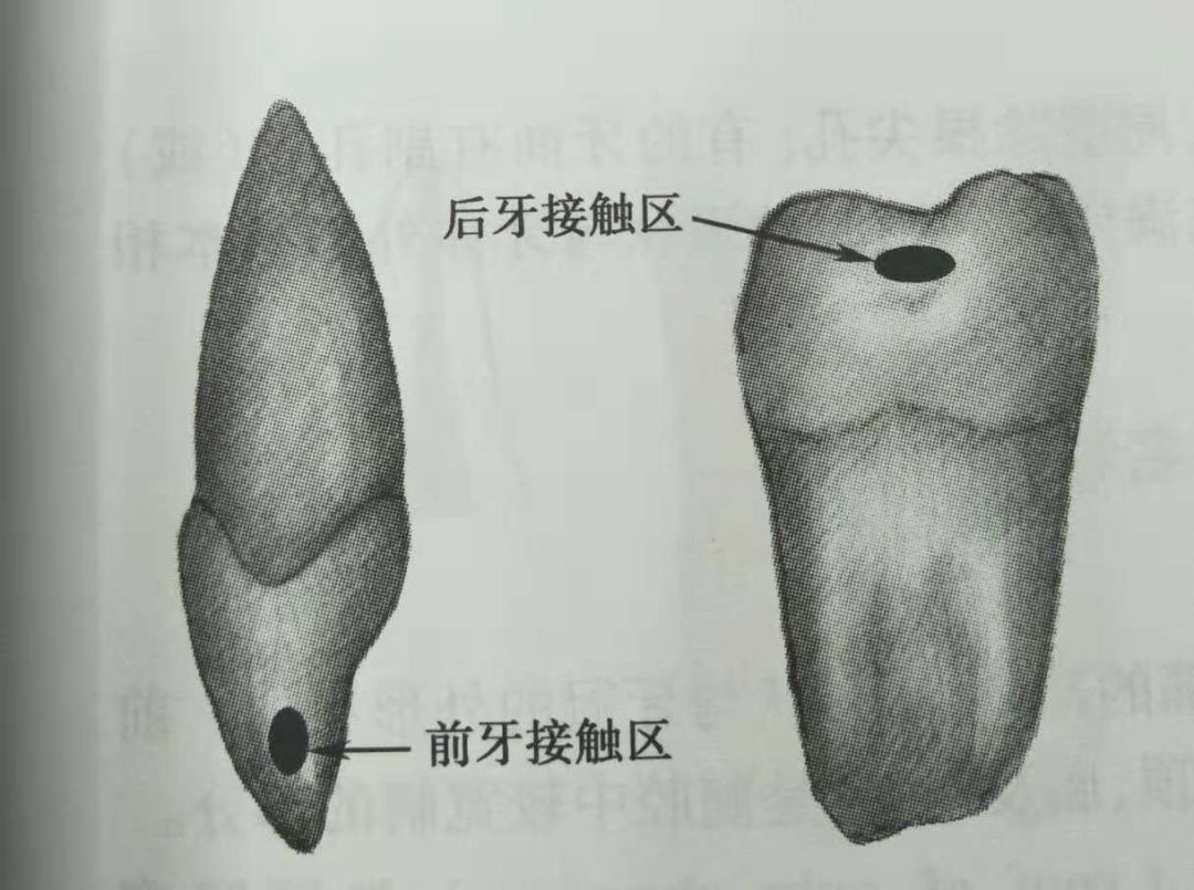 20181116百会口腔都是出来混的蛀牙你凭啥比我贵