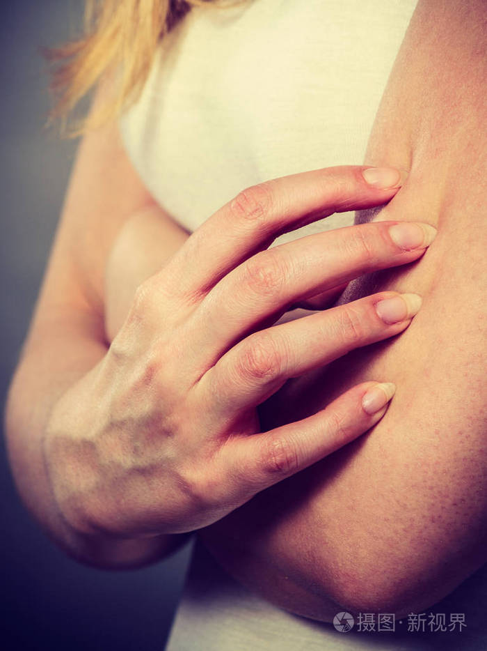 女人抓痒胳膊与过敏皮疹