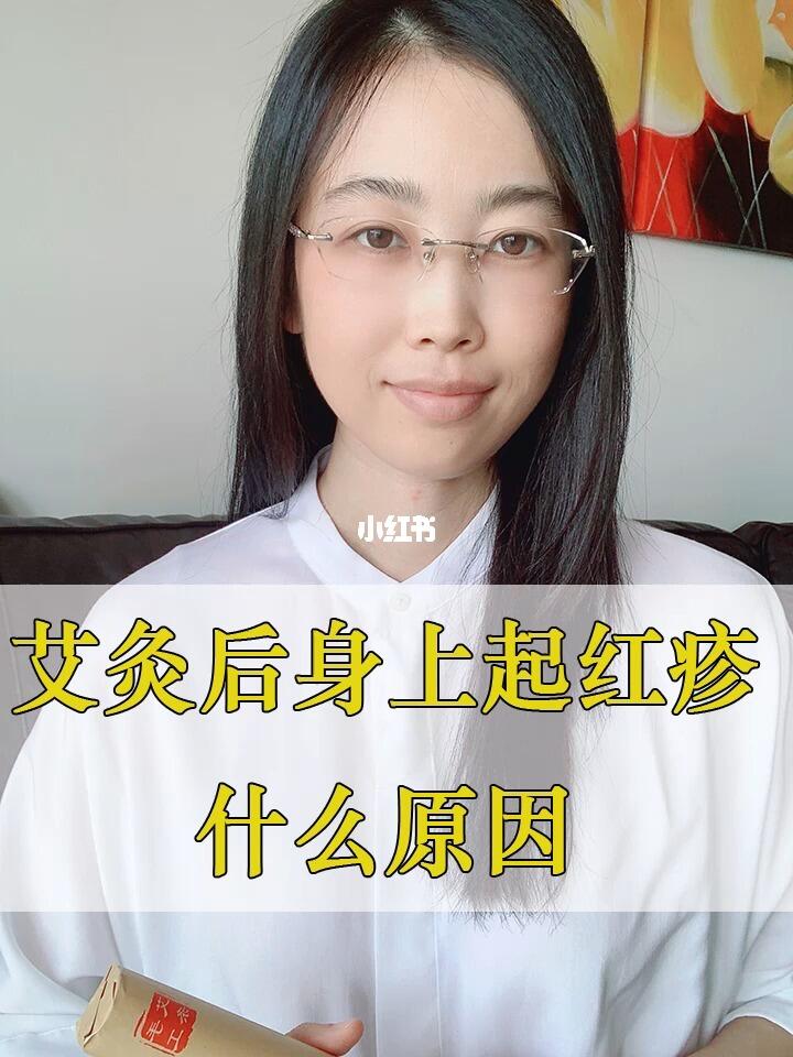 艾灸后身上起红疹是什么原因,艾灸后起疹子怎么回事 #艾灸   #红疹