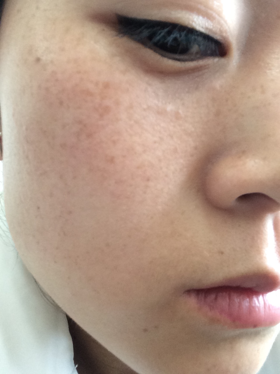 脸上的斑越来越多