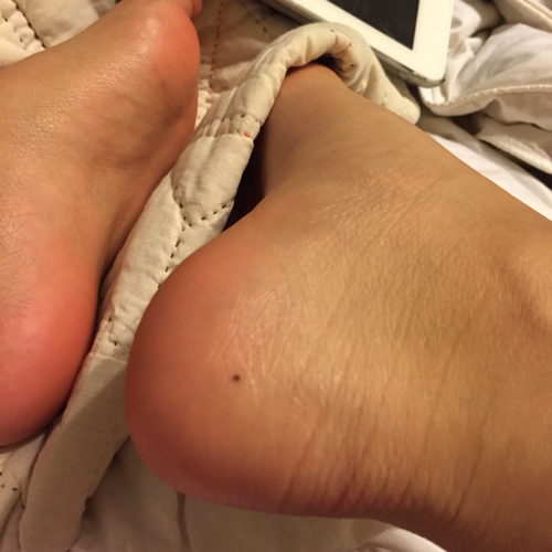 脚后跟上有一颗如图的黑痣 请问这象征着什么?