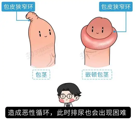 男生不能说的痛丁丁嵌顿会导致哪些后果如何复原