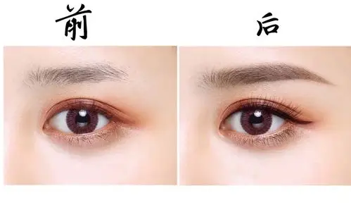 先来看一下前后对比图吧