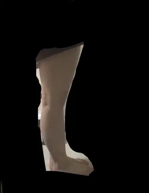 这个大腿该怎么减怎么穿